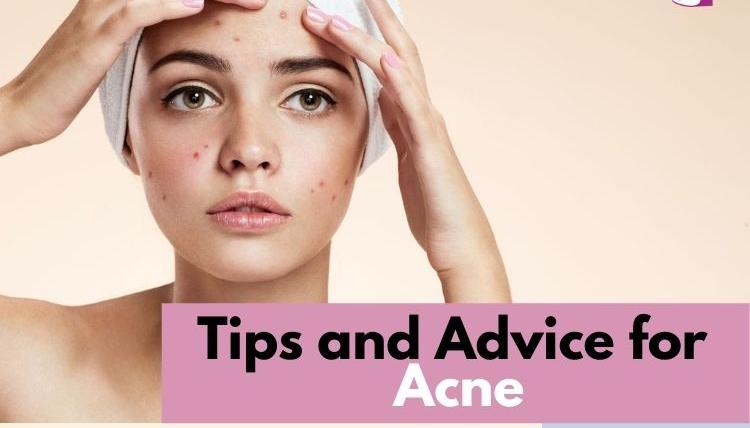 Tips and Advice for Acne