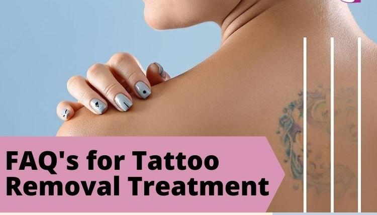 7 FAQs for tattoo removal treatment